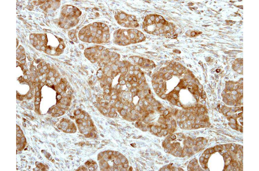 Immunohistochemistry - V-ATPase H antibody from Signalway Antibody (22086) - Antibodies.com