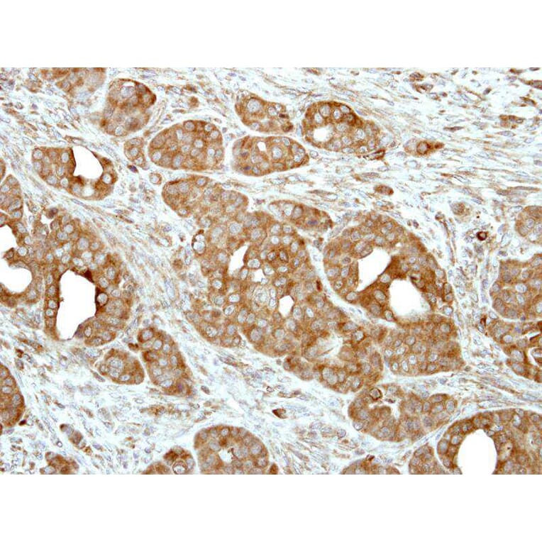 Immunohistochemistry - V-ATPase H antibody from Signalway Antibody (22086) - Antibodies.com