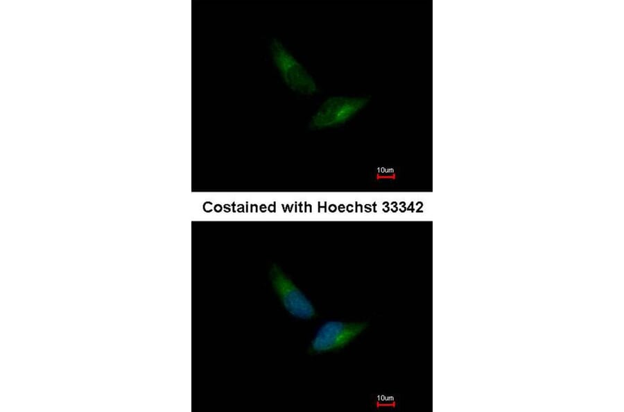 Immunofluorescence - V-ATPase H antibody from Signalway Antibody (22086) - Antibodies.com