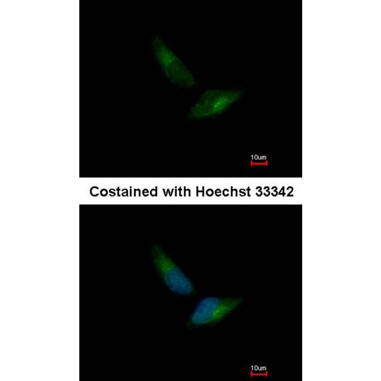 Immunofluorescence - V-ATPase H antibody from Signalway Antibody (22086) - Antibodies.com