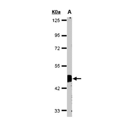 Flotillin-2 antibody from Signalway Antibody (22214) - Antibodies.com