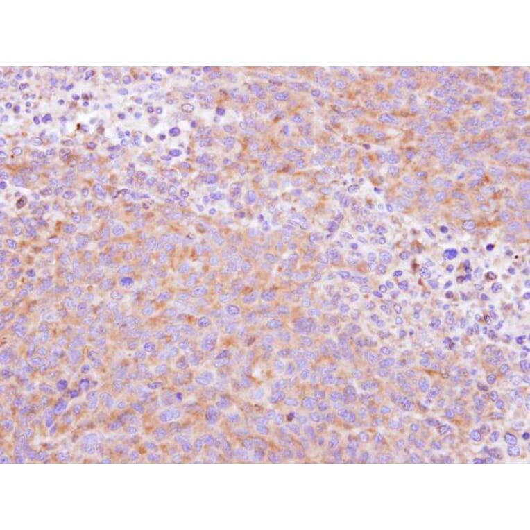 Immunohistochemistry - SCY1 like 3 antibody from Signalway Antibody (22300) - Antibodies.com