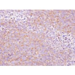 Immunohistochemistry - SCY1 like 3 antibody from Signalway Antibody (22300) - Antibodies.com