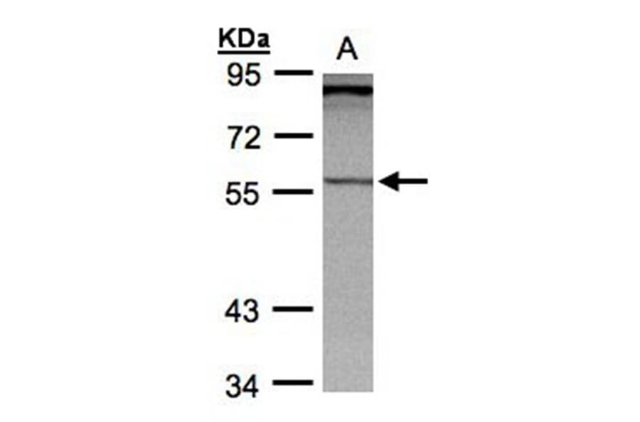 PCCase beta antibody from Signalway Antibody (22519) - Antibodies.com