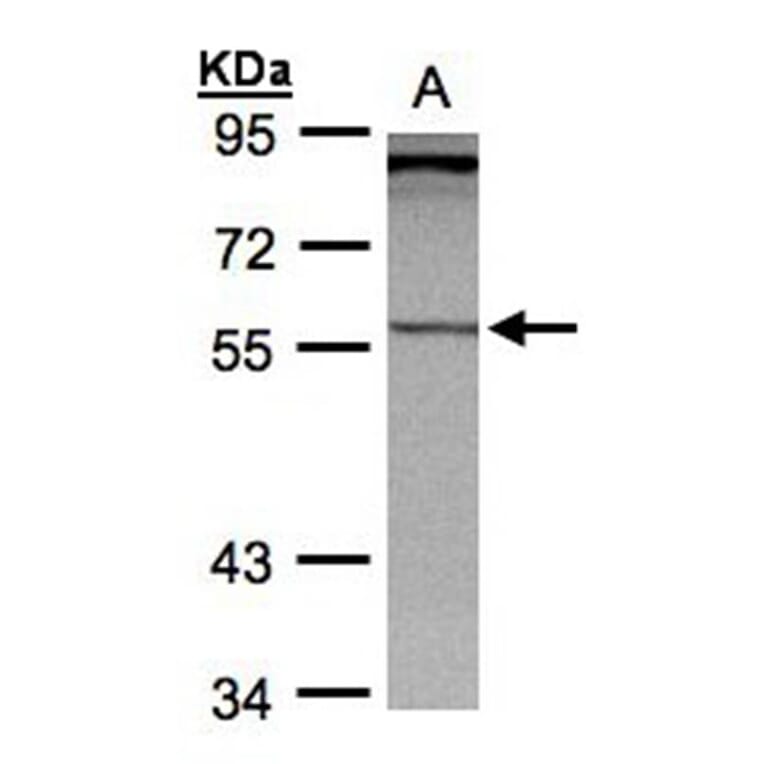 PCCase beta antibody from Signalway Antibody (22519) - Antibodies.com