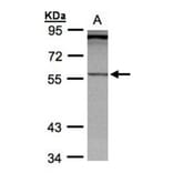 PCCase beta antibody from Signalway Antibody (22519) - Antibodies.com