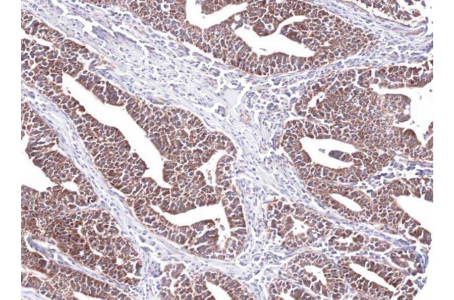 Immunohistochemistry - PCCase beta antibody from Signalway Antibody (22519) - Antibodies.com