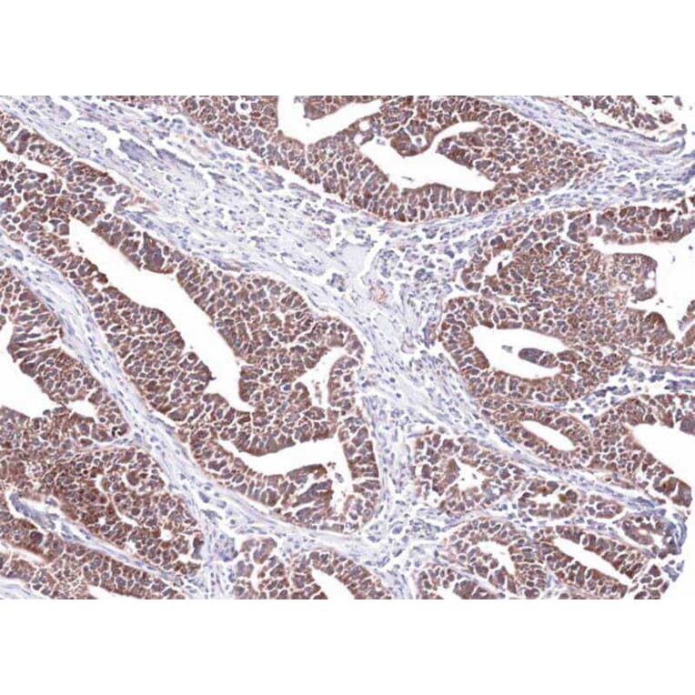 Immunohistochemistry - PCCase beta antibody from Signalway Antibody (22519) - Antibodies.com