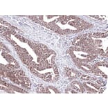 Immunohistochemistry - PCCase beta antibody from Signalway Antibody (22519) - Antibodies.com