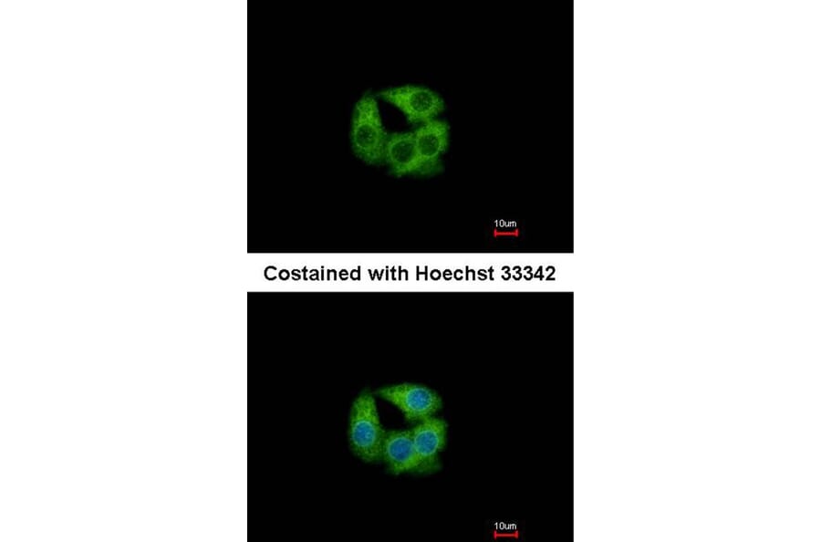 Immunofluorescence - PCCase beta antibody from Signalway Antibody (22519) - Antibodies.com