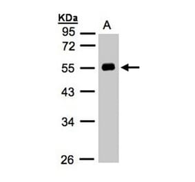 Angiotensin antibody from Signalway Antibody (22961) - Antibodies.com