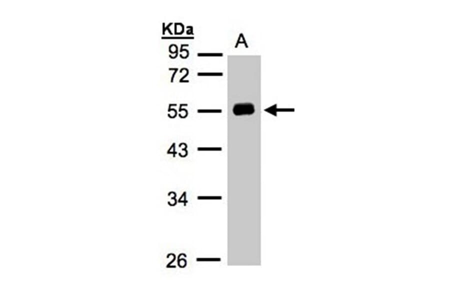 Angiotensin antibody from Signalway Antibody (22961) - Antibodies.com
