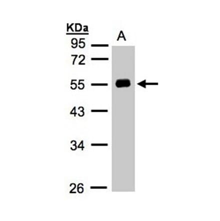 Angiotensin antibody from Signalway Antibody (22961) - Antibodies.com