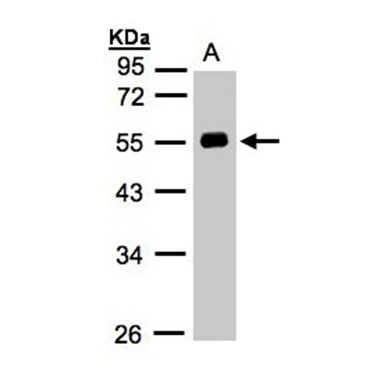 Angiotensin antibody from Signalway Antibody (22961) - Antibodies.com