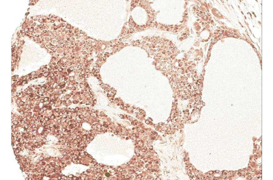 Immunohistochemistry - Angiotensin antibody from Signalway Antibody (22961) - Antibodies.com