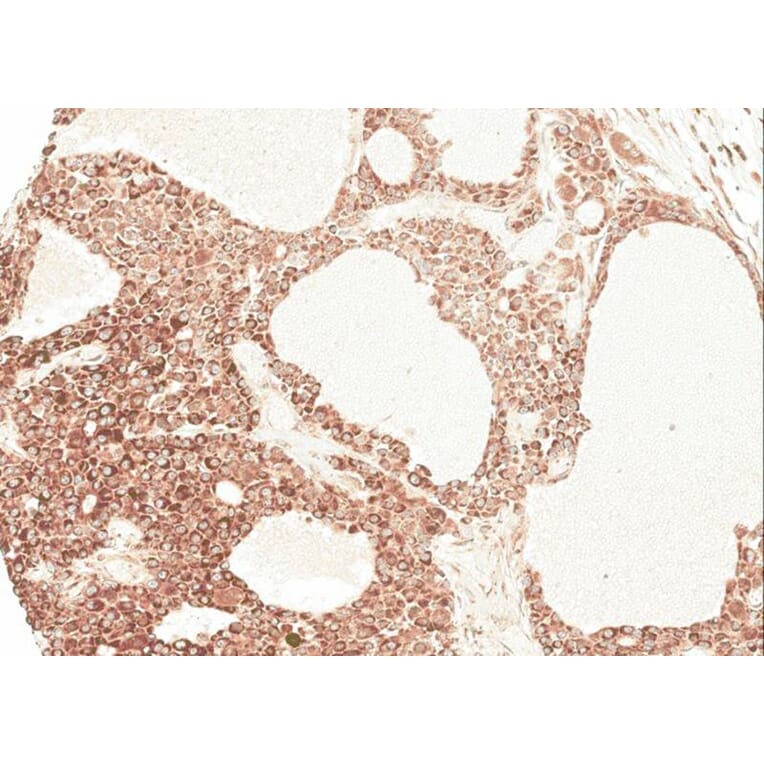 Immunohistochemistry - Angiotensin antibody from Signalway Antibody (22961) - Antibodies.com