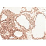 Immunohistochemistry - Angiotensin antibody from Signalway Antibody (22961) - Antibodies.com