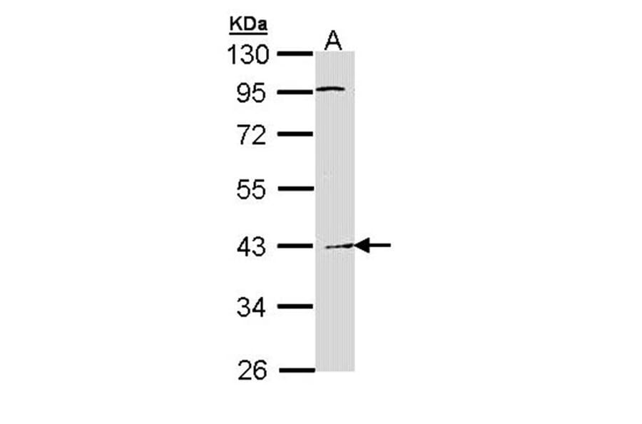 Haptoglobin antibody from Signalway Antibody (23016) - Antibodies.com