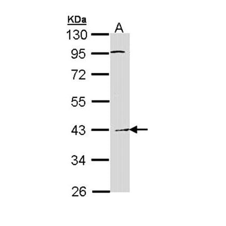 Haptoglobin antibody from Signalway Antibody (23016) - Antibodies.com