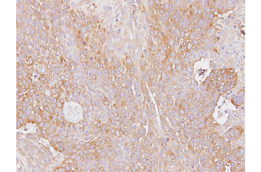 Immunohistochemistry - Haptoglobin antibody from Signalway Antibody (23016) - Antibodies.com