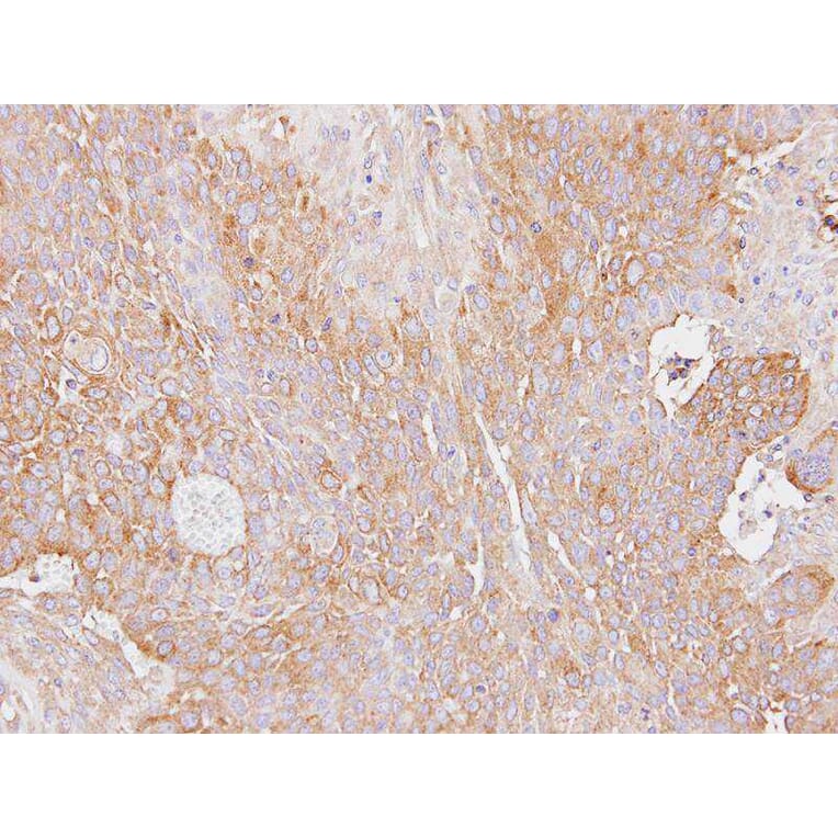Immunohistochemistry - Haptoglobin antibody from Signalway Antibody (23016) - Antibodies.com