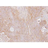 Immunohistochemistry - Haptoglobin antibody from Signalway Antibody (23016) - Antibodies.com