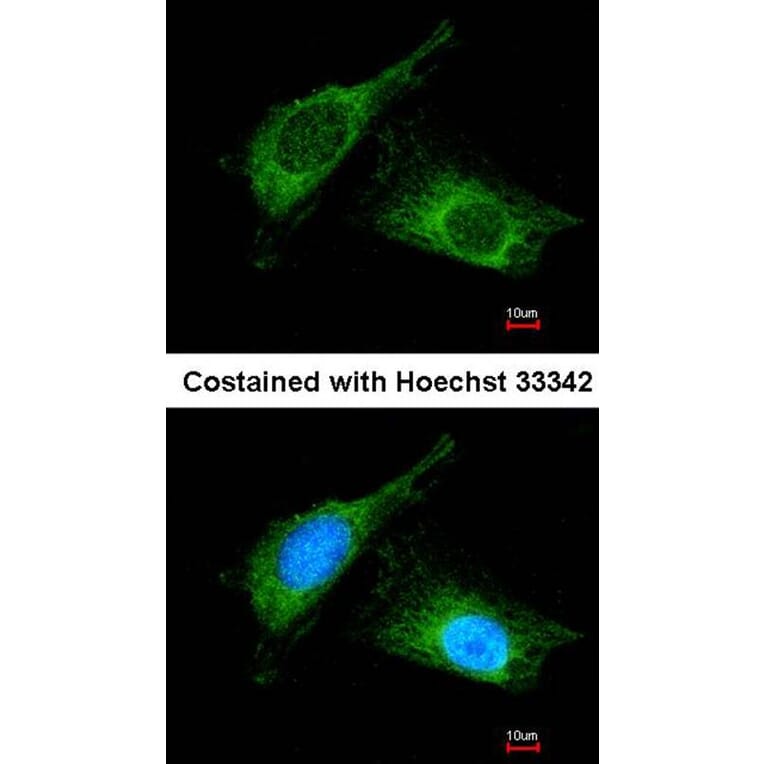 Immunofluorescence - Haptoglobin antibody from Signalway Antibody (23016) - Antibodies.com