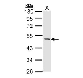 Haptoglobin antibody from Signalway Antibody (23017) - Antibodies.com