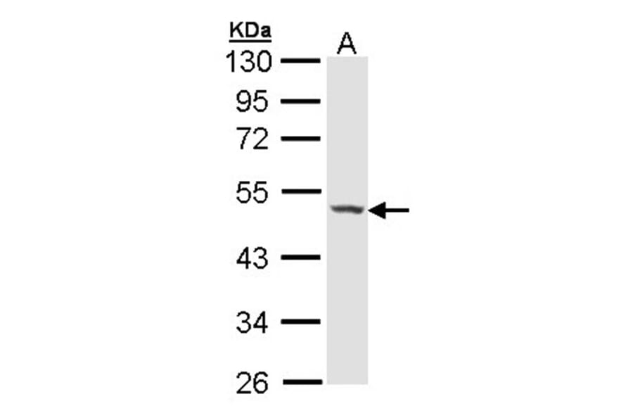 Haptoglobin antibody from Signalway Antibody (23017) - Antibodies.com