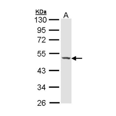 Haptoglobin antibody from Signalway Antibody (23017) - Antibodies.com