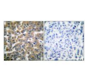 Immunohistochemistry - GR (Ab-211) Antibody from Signalway Antibody (33123) - Antibodies.com