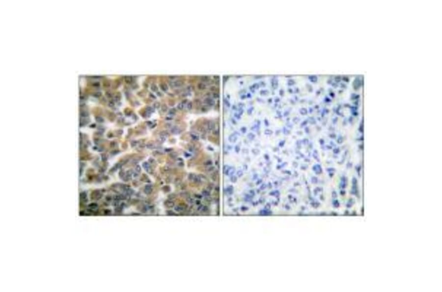 Immunohistochemistry - GR (Ab-211) Antibody from Signalway Antibody (33123) - Antibodies.com