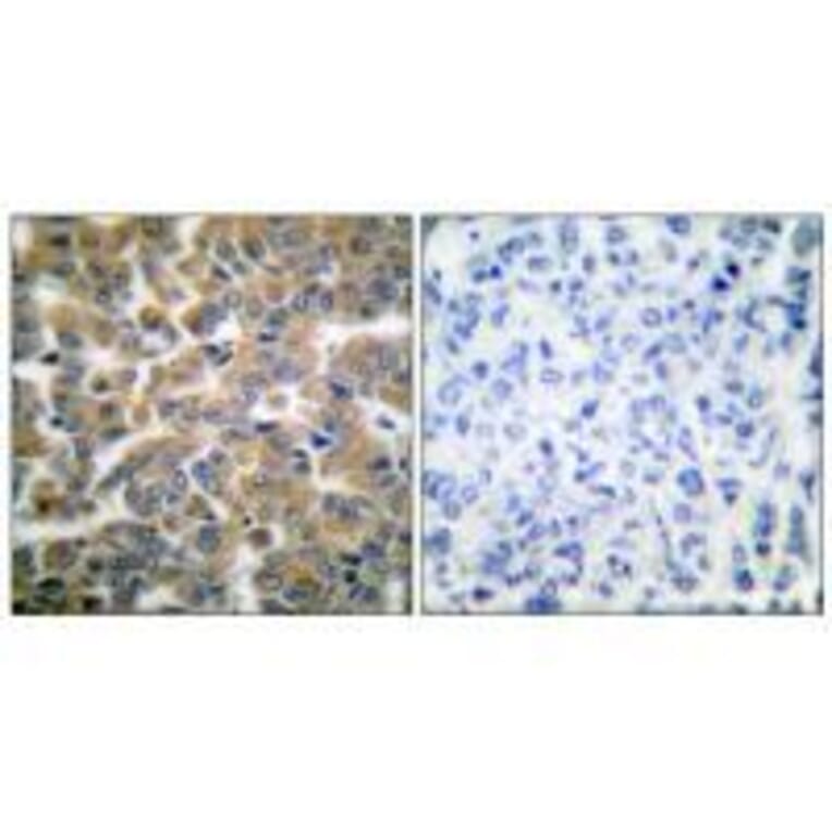 Immunohistochemistry - GR (Ab-211) Antibody from Signalway Antibody (33123) - Antibodies.com