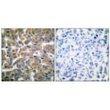 Immunohistochemistry - GR (Ab-211) Antibody from Signalway Antibody (33123) - Antibodies.com