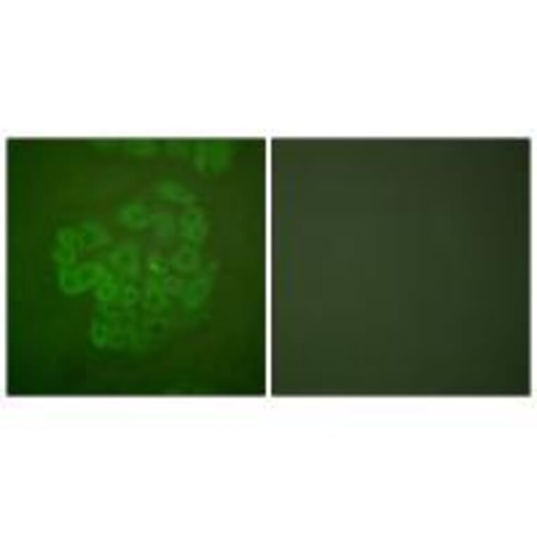 Immunofluorescence - GR (Ab-211) Antibody from Signalway Antibody (33123) - Antibodies.com