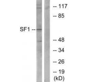 Western blot - SF1 (Ab-82) Antibody from Signalway Antibody (33142) - Antibodies.com
