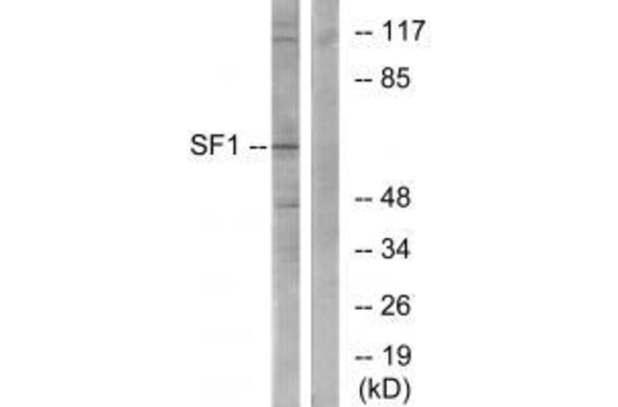 Western blot - SF1 (Ab-82) Antibody from Signalway Antibody (33142) - Antibodies.com