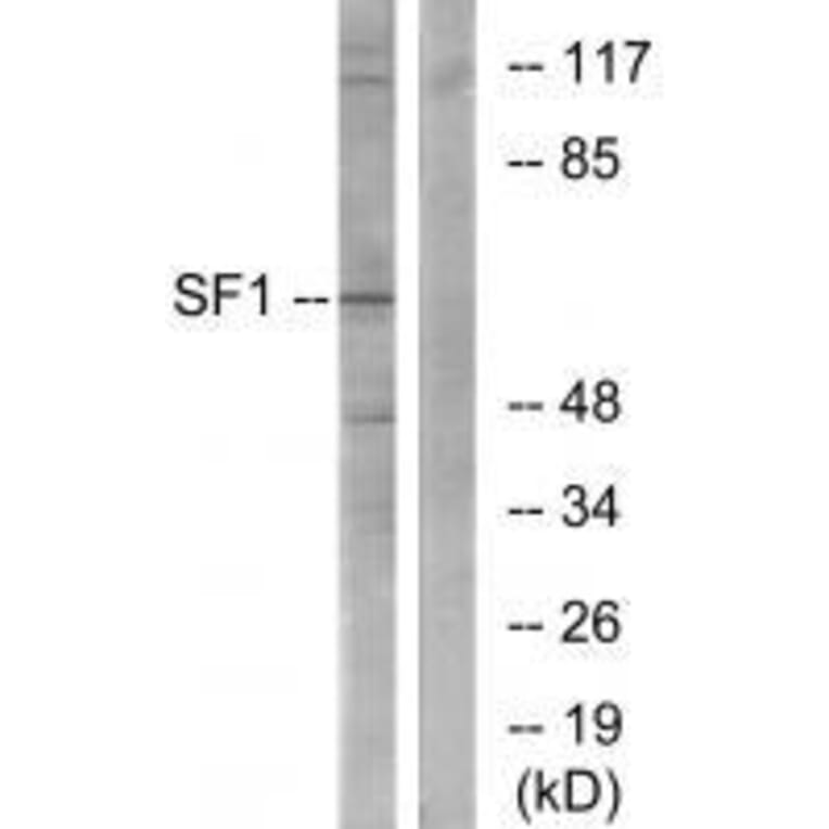 Western blot - SF1 (Ab-82) Antibody from Signalway Antibody (33142) - Antibodies.com