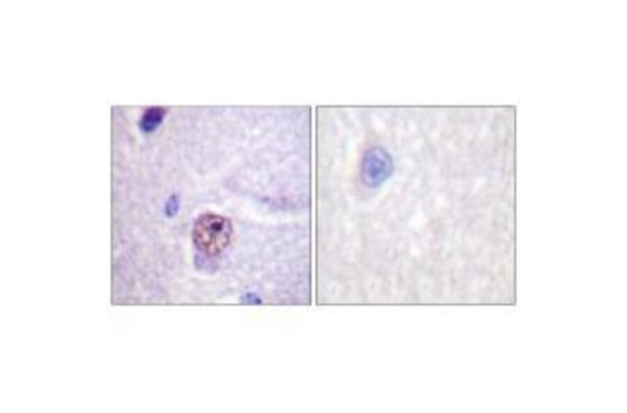 Immunohistochemistry - SF1 (Ab-82) Antibody from Signalway Antibody (33142) - Antibodies.com