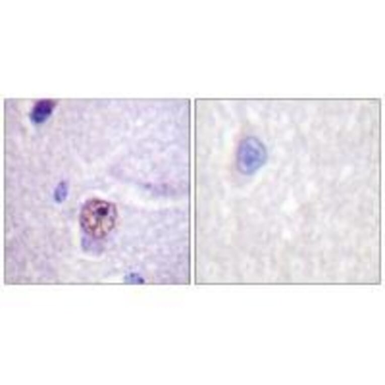 Immunohistochemistry - SF1 (Ab-82) Antibody from Signalway Antibody (33142) - Antibodies.com