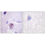Immunohistochemistry - SF1 (Ab-82) Antibody from Signalway Antibody (33142) - Antibodies.com