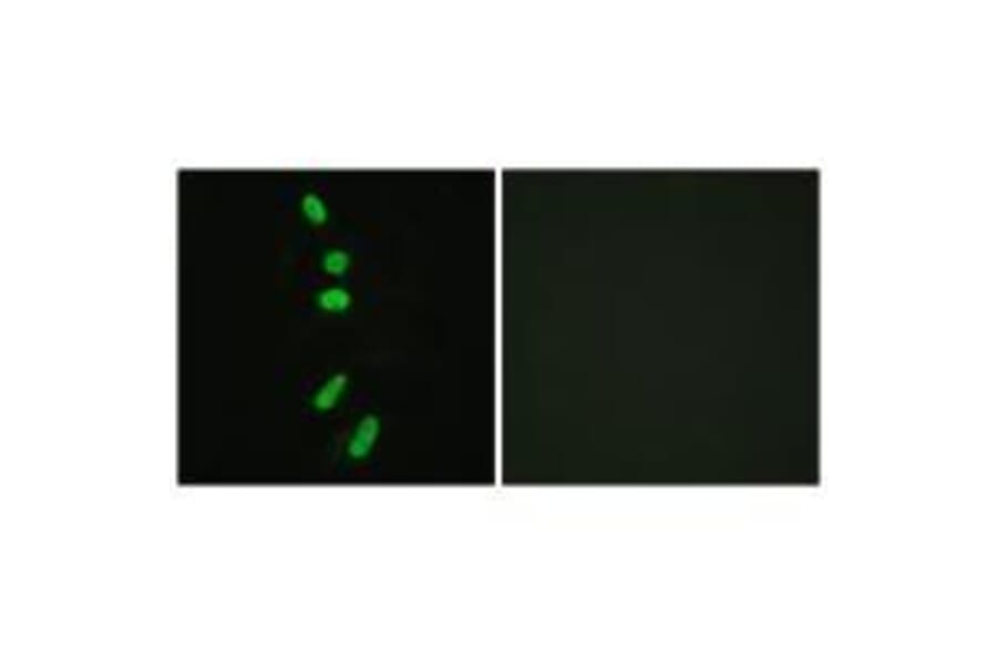 Immunofluorescence - SF1 (Ab-82) Antibody from Signalway Antibody (33142) - Antibodies.com