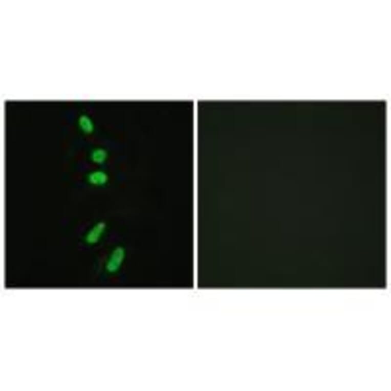Immunofluorescence - SF1 (Ab-82) Antibody from Signalway Antibody (33142) - Antibodies.com