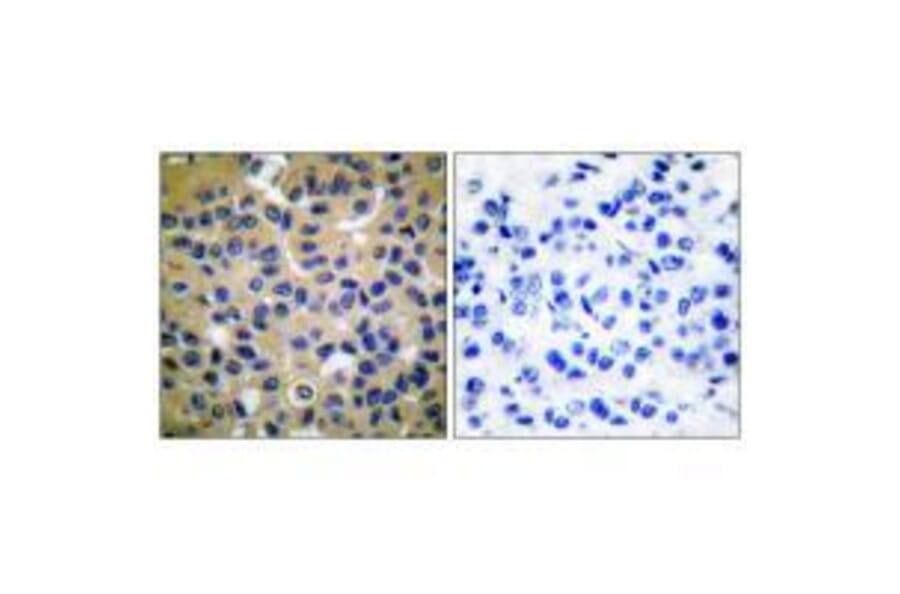 Immunohistochemistry - Collagen II Antibody from Signalway Antibody (33340) - Antibodies.com