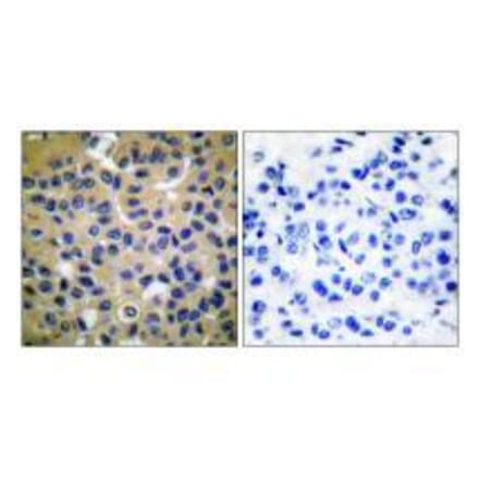 Immunohistochemistry - Collagen II Antibody from Signalway Antibody (33340) - Antibodies.com