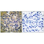 Immunohistochemistry - Collagen II Antibody from Signalway Antibody (33340) - Antibodies.com