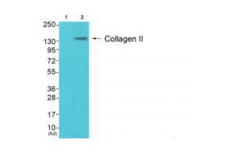Western blot - Collagen II Antibody from Signalway Antibody (33340) - Antibodies.com