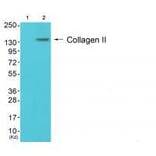 Western blot - Collagen II Antibody from Signalway Antibody (33340) - Antibodies.com