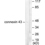 Western blot - Connexin 43 Antibody from Signalway Antibody (33343) - Antibodies.com