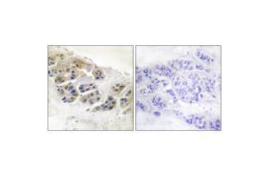 Immunohistochemistry - Mammaglobin Antibody from Signalway Antibody (33427) - Antibodies.com